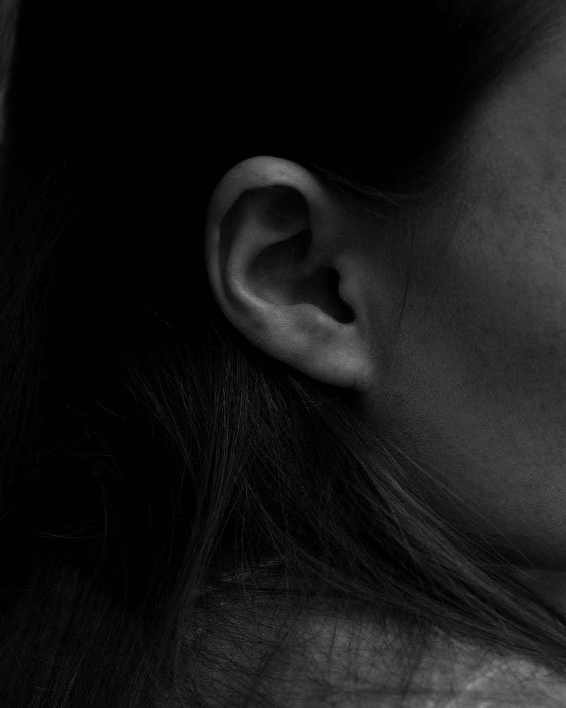 Otoplastia: Corrección de orejas prominentes